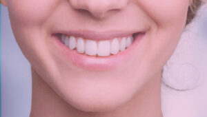 איך תשמרו על השיניים שלכם